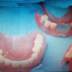 Зубопротезирование